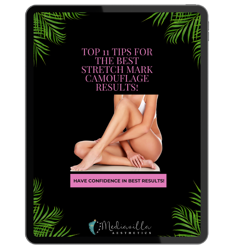 Stretch Mark Camouflage Course Freebie